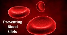 Preventing Blood Clots: A Lifesaving Guide. Picture of blood particles floating around.